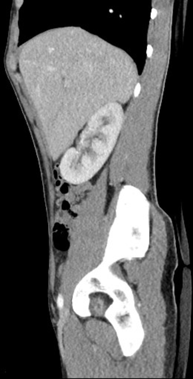 Schwarze und weiße MRI-Aufnahme eines Kniegelenks, die detaillierte Anatomie zeigt.